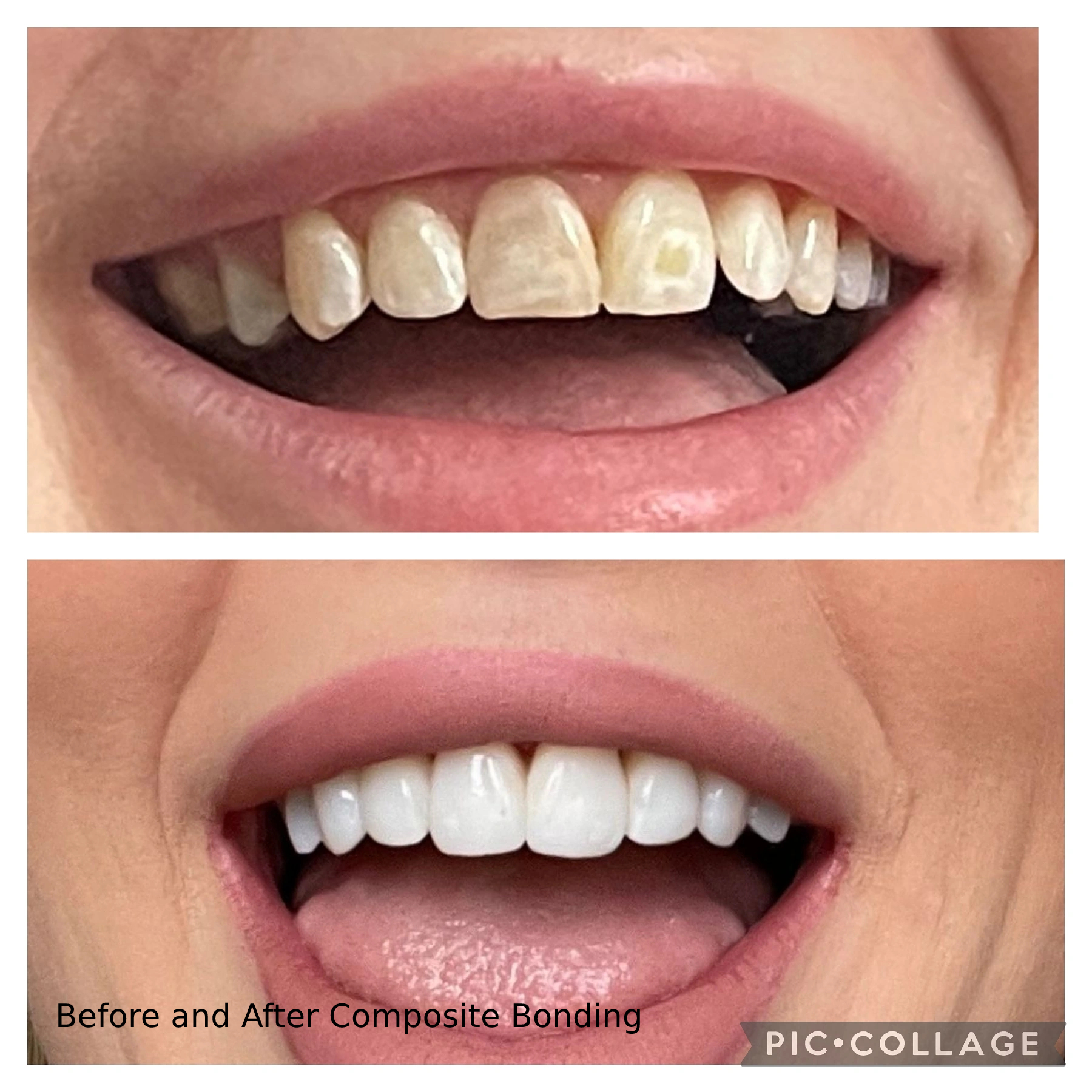 before-after-composite.jpg