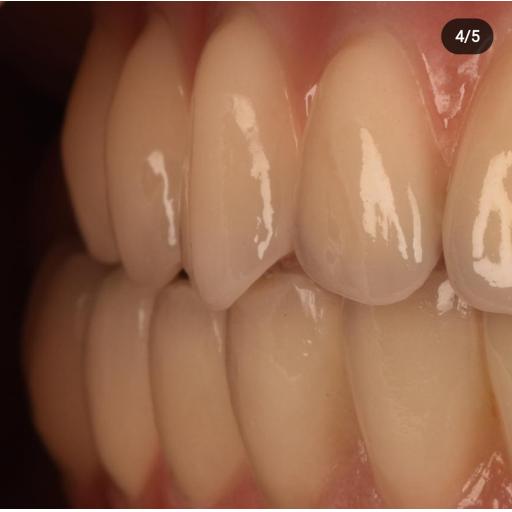 Dental Implants in Stafford