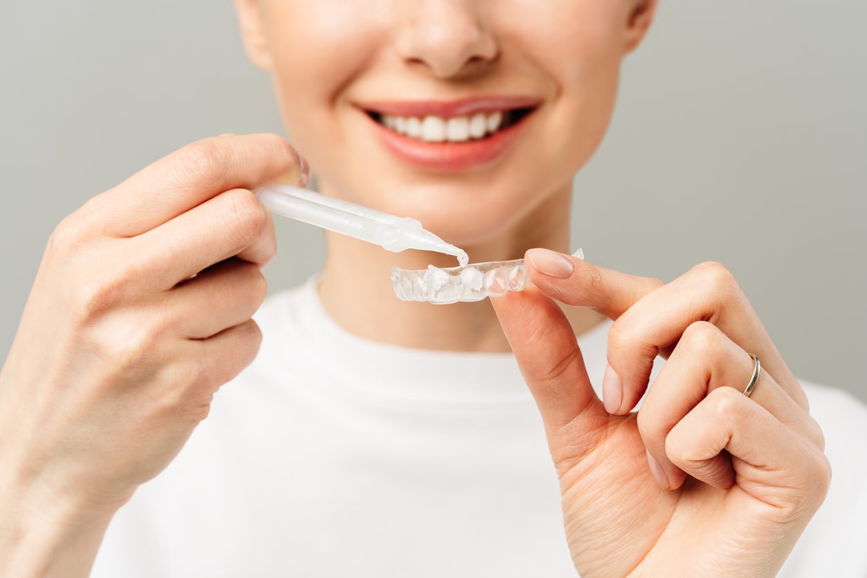 Brighten Your Smile: Teeth Whitening in Stafford