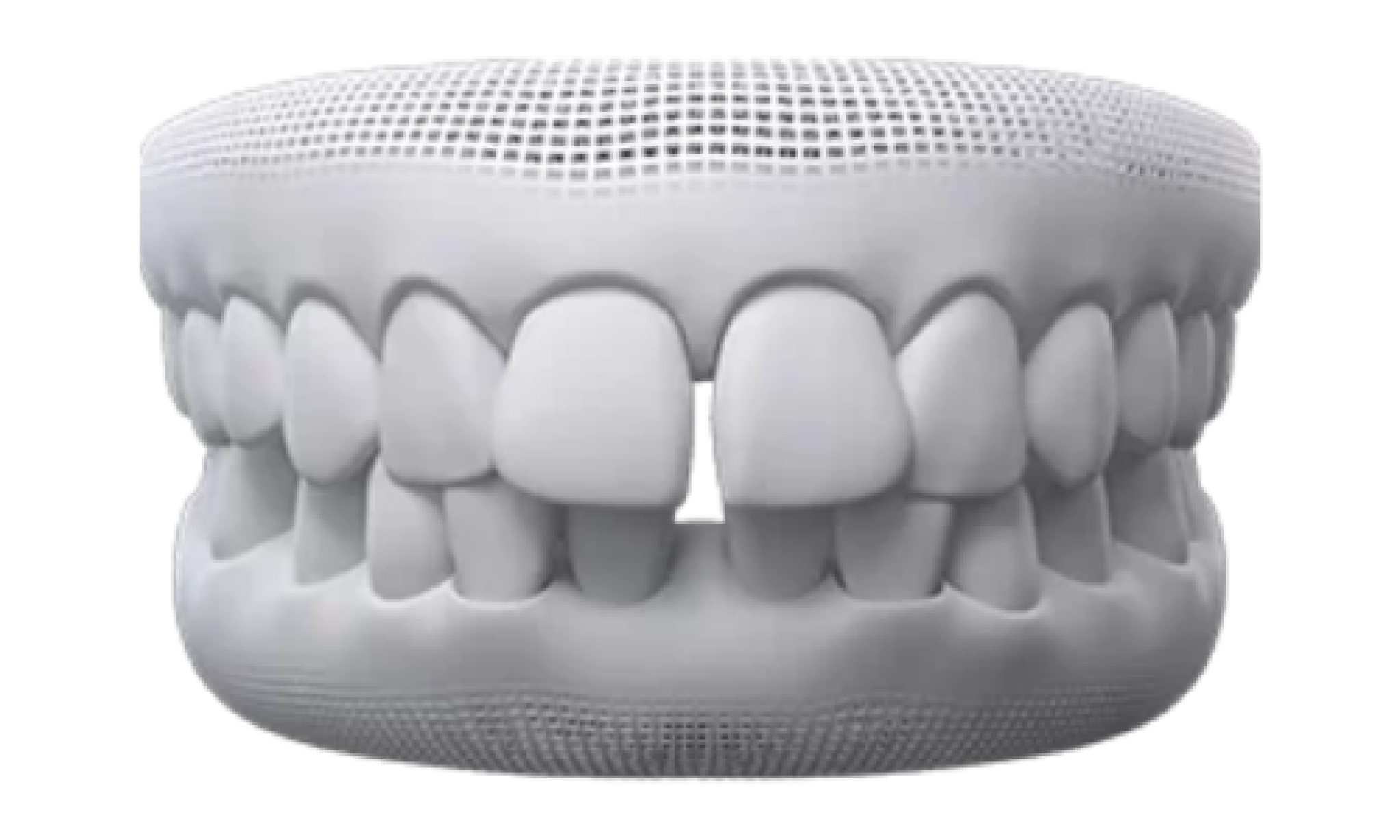 what can invisalign fix - gaps between teeth.png